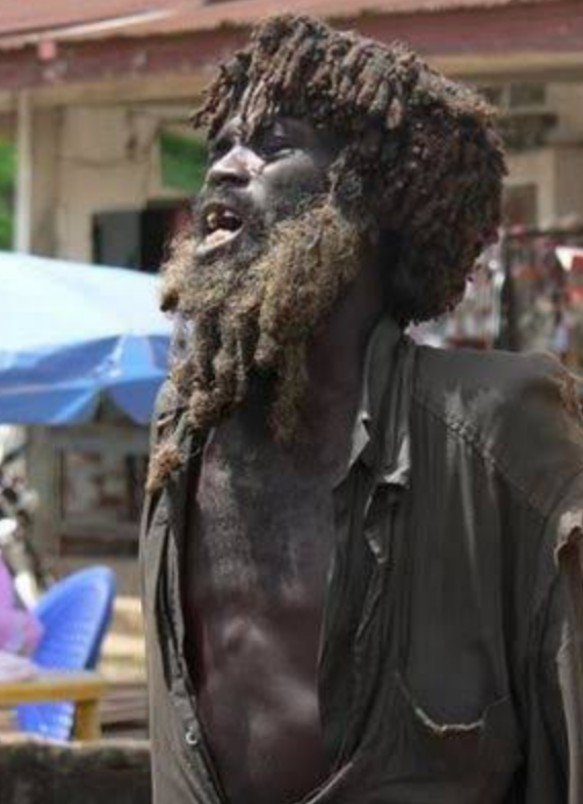 85% of Nigerians suffering mental problems are youths – Medical expert