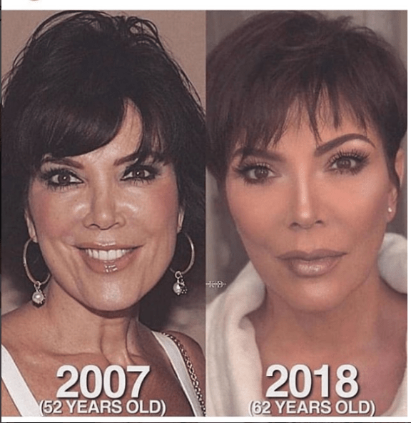 Check Out Kris Jenner’s Photo In 2007 Vs 2018… DAMN!!! What A TRANSFORMATION!