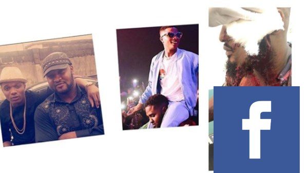 Wizkid’s bodyguard macheted for defending him (graphic photos)