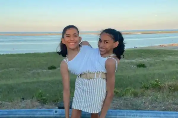Meet the conjoined twins sharing a vag!na